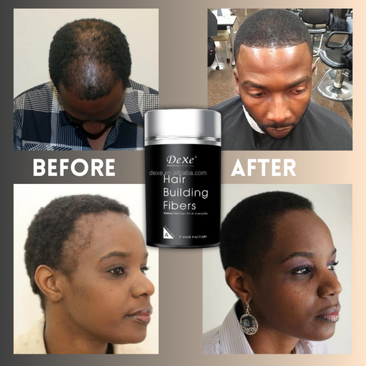 Hair Building Fiber For Men And Women