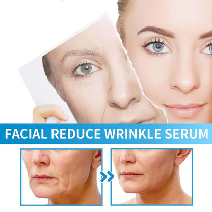 B5 Wrinkle Face Serum