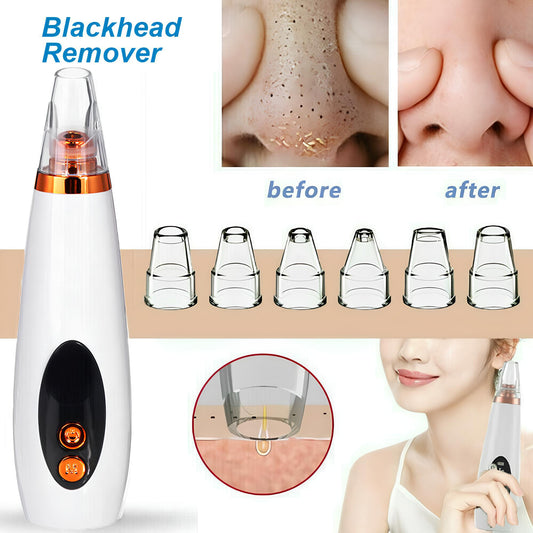 BLACKHEAD REMOVER